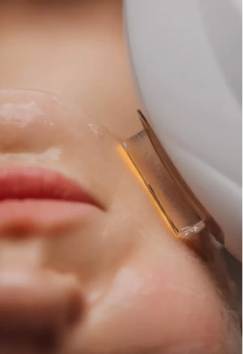 Laser skin renewal